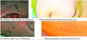 [VIDEO] Prokuratura wykluczyła pobicie i gwałt Magdaleny Żuk. Również handel ludźmi ze strony Markusa. Przesłuchuje świadków, zleci ponowną sekcję zwłok we Wrocławiu i zbada dokumentację medyczną 27-latki z poprzednich lat pod kątem załamania nerwowego